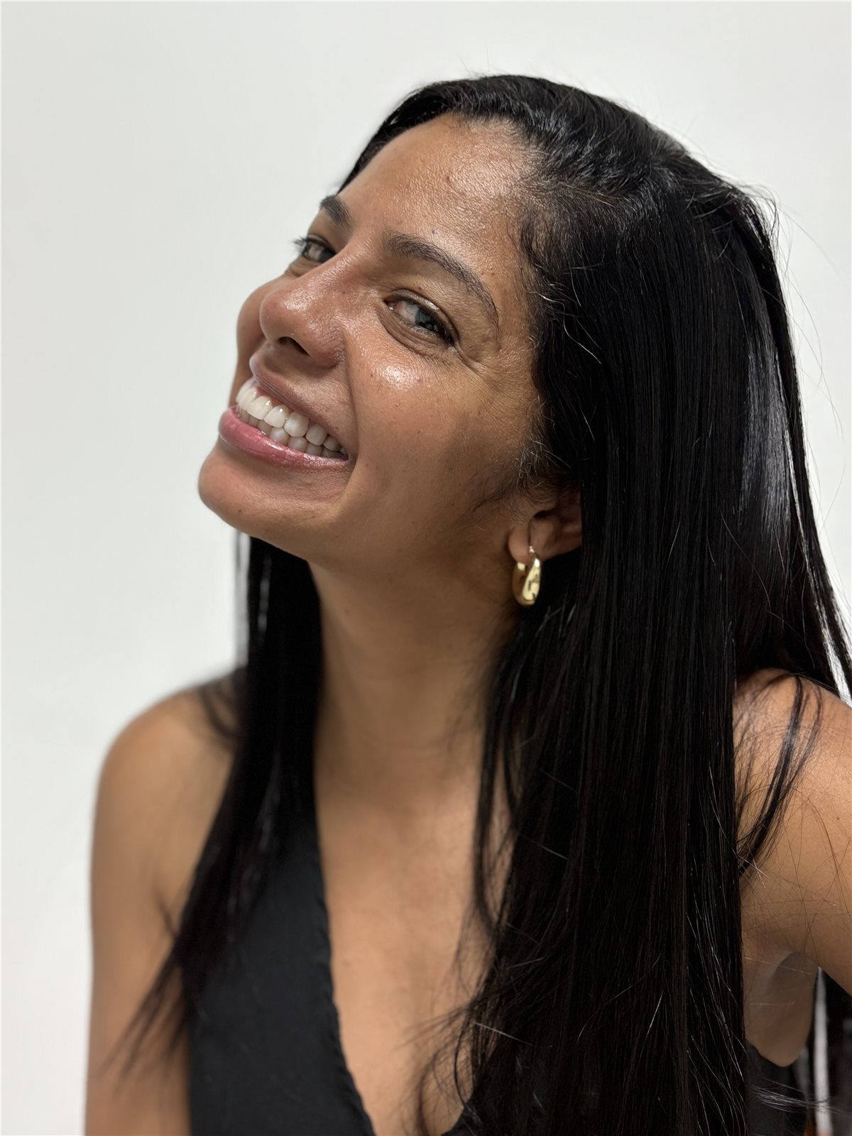 Smile design after treatment profile smile